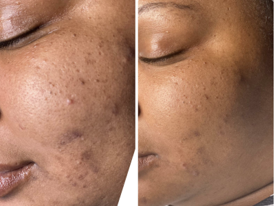 Screenshot 2025-03-04 at 6.17.32 PM